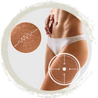 Cryo C-life pour corps